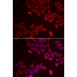 Immunofluorescence - LGALS8 antibody from Signalway Antibody (39068) - Antibodies.com