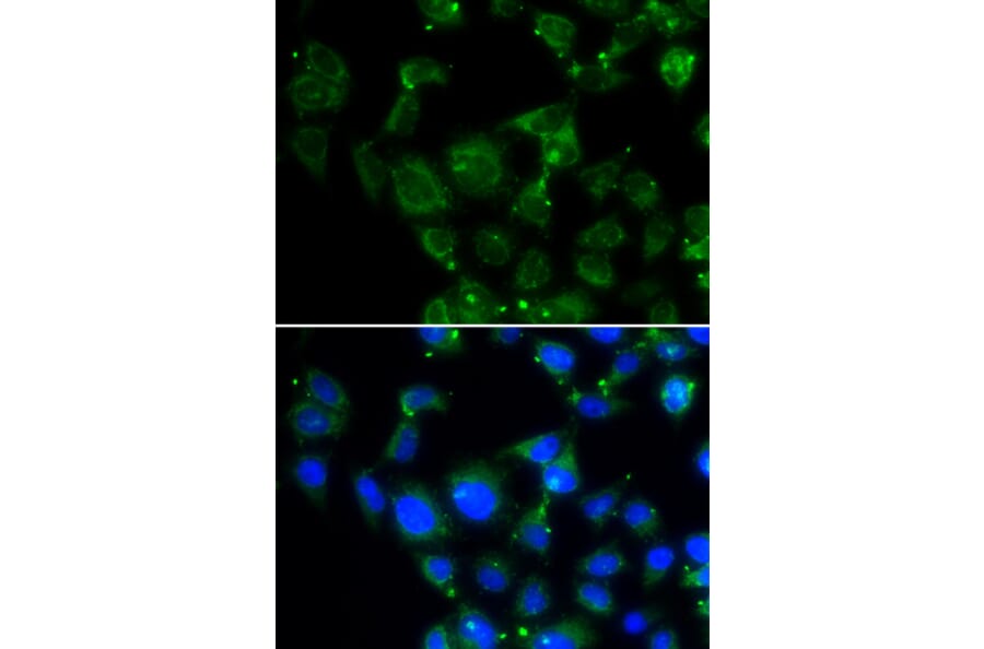 Immunofluorescence - MAPRE2 antibody from Signalway Antibody (39070) - Antibodies.com