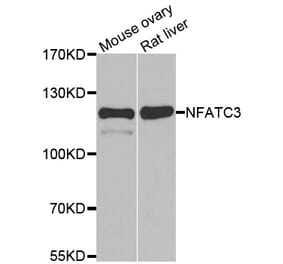 Western blot - NFATC3 antibody from Signalway Antibody (39086) - Antibodies.com