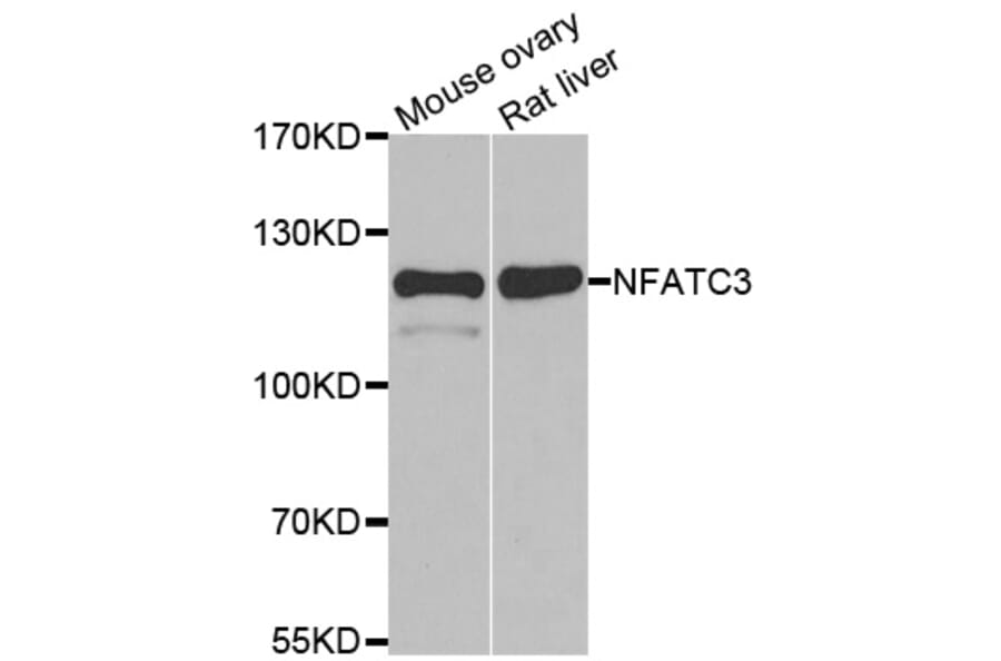 Western blot - NFATC3 antibody from Signalway Antibody (39086) - Antibodies.com