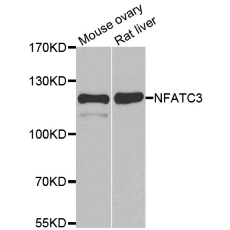 Western blot - NFATC3 antibody from Signalway Antibody (39086) - Antibodies.com