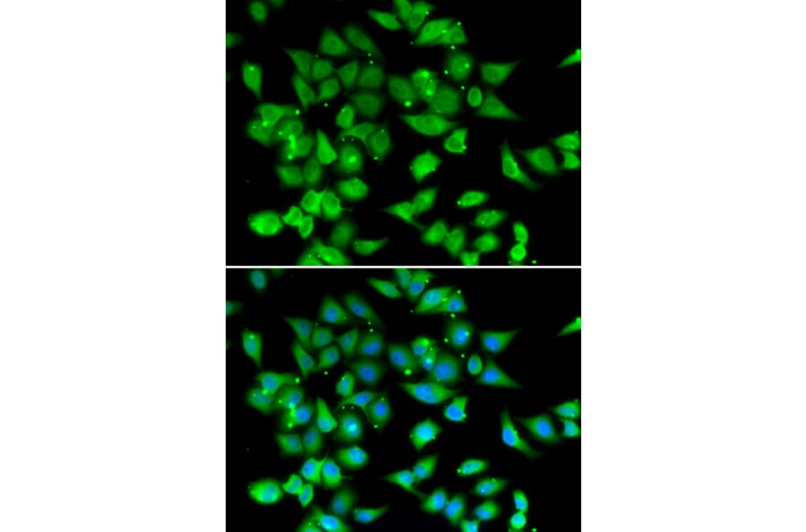 Immunofluorescence - NFATC3 antibody from Signalway Antibody (39086) - Antibodies.com