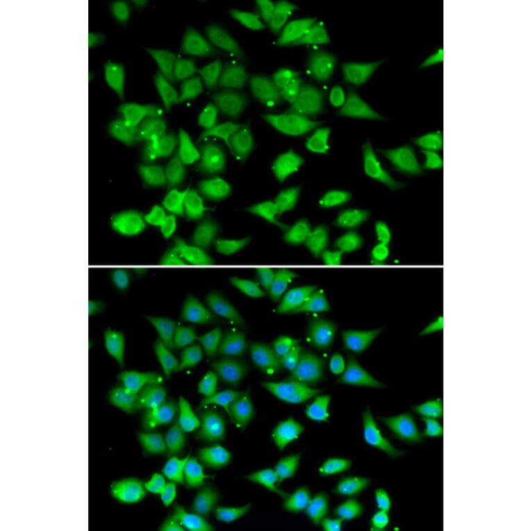 Immunofluorescence - NFATC3 antibody from Signalway Antibody (39086) - Antibodies.com