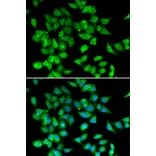 Immunofluorescence - NFATC3 antibody from Signalway Antibody (39086) - Antibodies.com