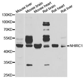 Western blot - NHLRC1 antibody from Signalway Antibody (39089) - Antibodies.com