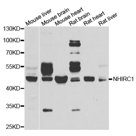 Western blot - NHLRC1 antibody from Signalway Antibody (39089) - Antibodies.com