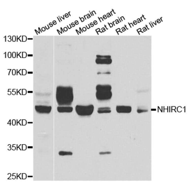 Western blot - NHLRC1 antibody from Signalway Antibody (39089) - Antibodies.com