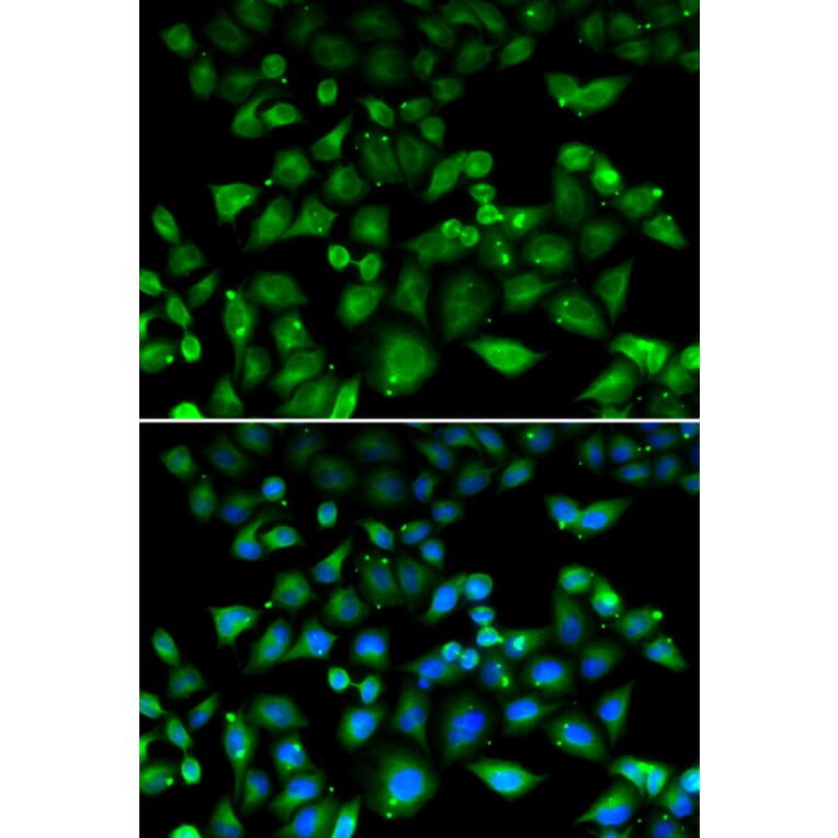 Immunofluorescence - NHLRC1 antibody from Signalway Antibody (39089) - Antibodies.com