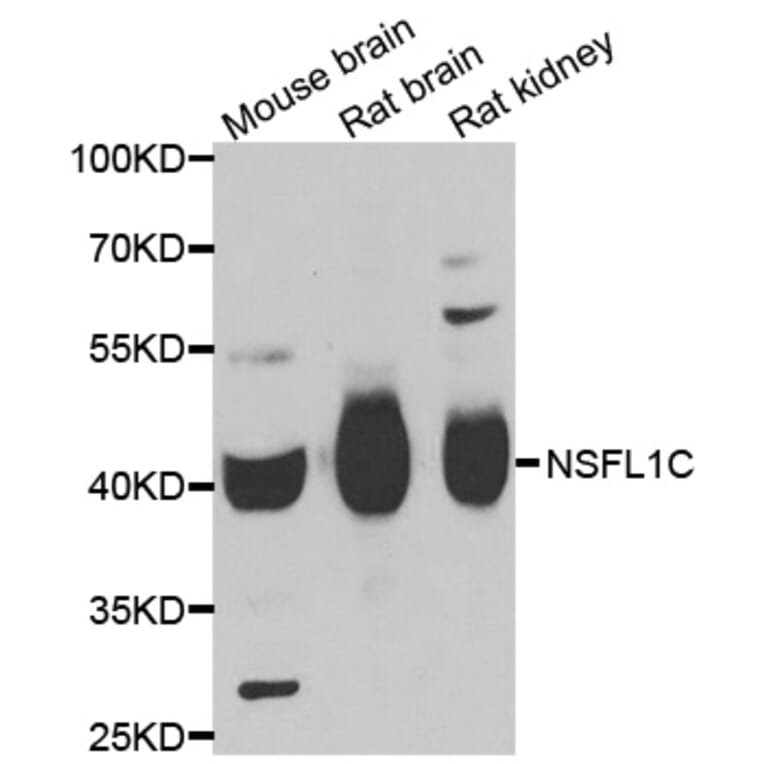 Western blot - NSFL1C antibody from Signalway Antibody (39093) - Antibodies.com