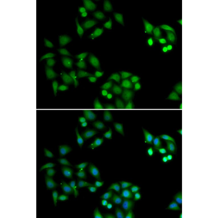 Immunofluorescence - NSFL1C antibody from Signalway Antibody (39093) - Antibodies.com
