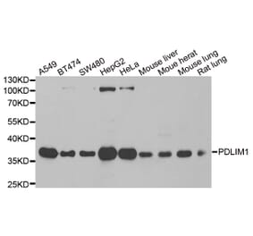 Western blot - PDLIM1 antibody from Signalway Antibody (39100) - Antibodies.com