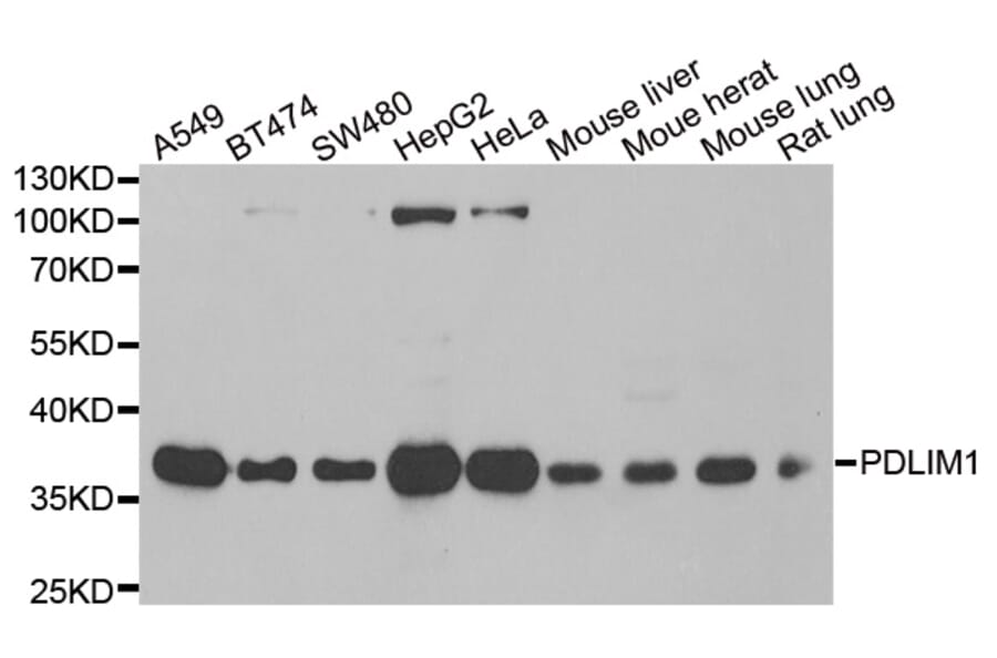 Western blot - PDLIM1 antibody from Signalway Antibody (39100) - Antibodies.com