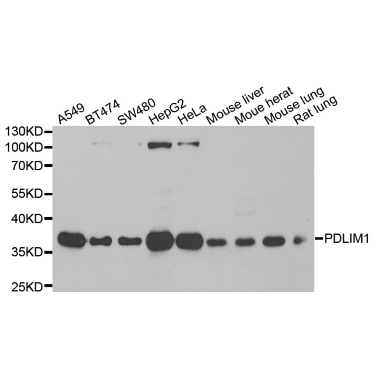 Western blot - PDLIM1 antibody from Signalway Antibody (39100) - Antibodies.com