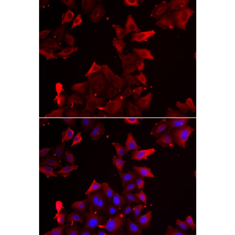 Immunofluorescence - PDLIM1 antibody from Signalway Antibody (39100) - Antibodies.com