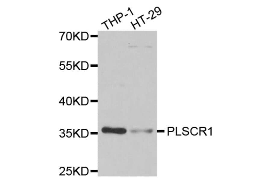 Western blot - PLSCR1 antibody from Signalway Antibody (39105) - Antibodies.com