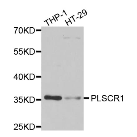 Western blot - PLSCR1 antibody from Signalway Antibody (39105) - Antibodies.com