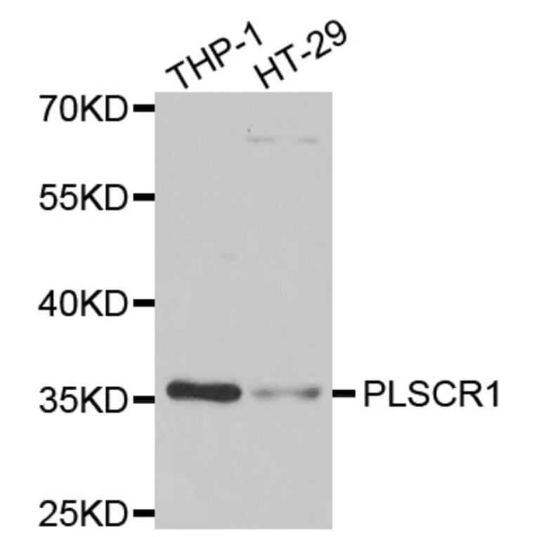 Western blot - PLSCR1 antibody from Signalway Antibody (39105) - Antibodies.com