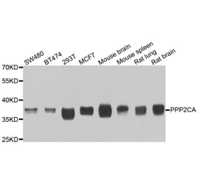 Western blot - PPP2CA antibody from Signalway Antibody (39115) - Antibodies.com