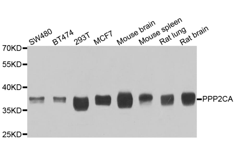 Western blot - PPP2CA antibody from Signalway Antibody (39115) - Antibodies.com