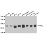 Western blot - PPP2CA antibody from Signalway Antibody (39115) - Antibodies.com