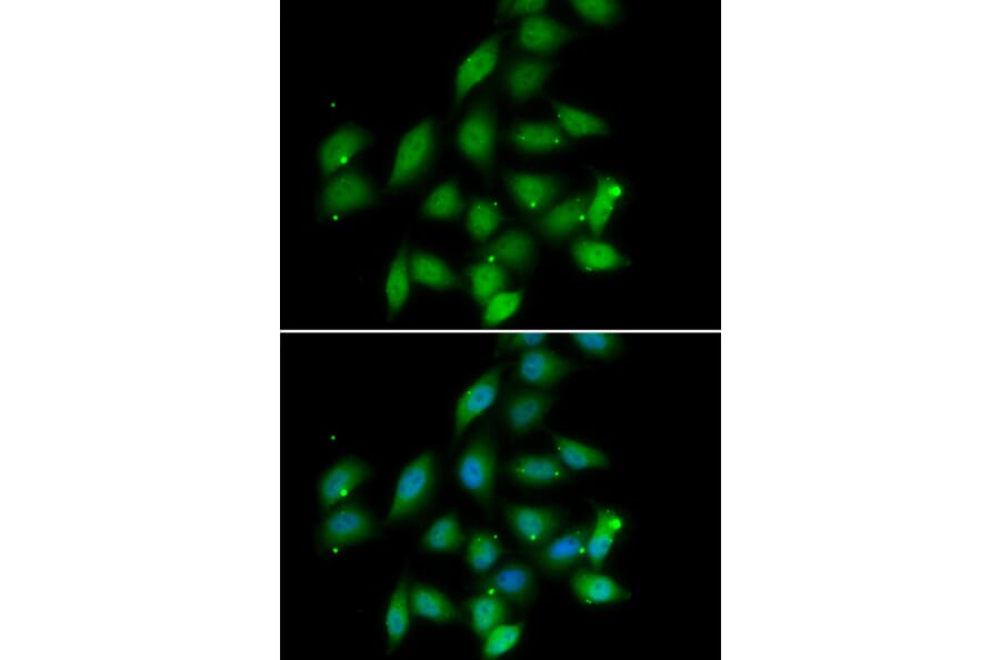 Immunofluorescence - PPP2CA antibody from Signalway Antibody (39115) - Antibodies.com
