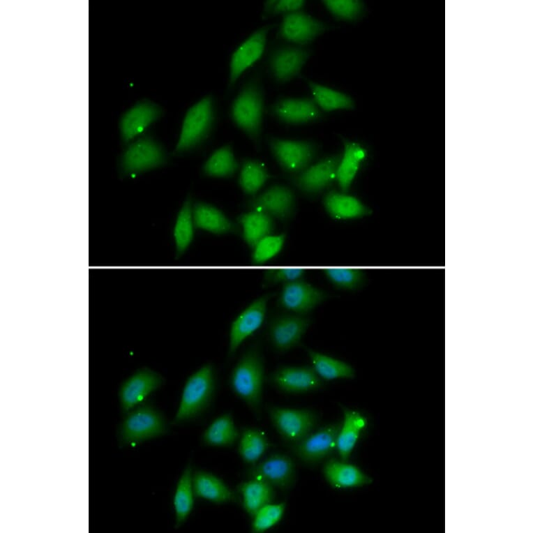 Immunofluorescence - PPP2CA antibody from Signalway Antibody (39115) - Antibodies.com
