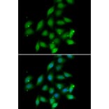 Immunofluorescence - PPP2CA antibody from Signalway Antibody (39115) - Antibodies.com