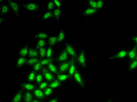 Immunofluorescence analysis of HeLa cell using SETMAR antibody.
