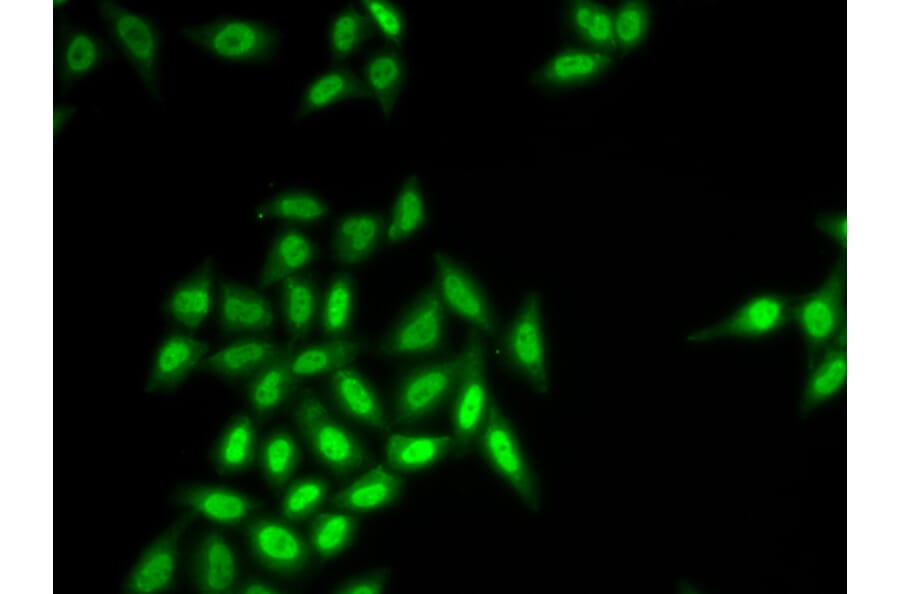Immunofluorescence - SETMAR antibody from Signalway Antibody (39143) - Antibodies.com