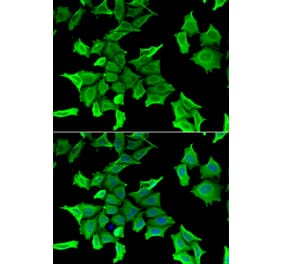 Immunofluorescence - SPINT2 antibody from Signalway Antibody (39150) - Antibodies.com