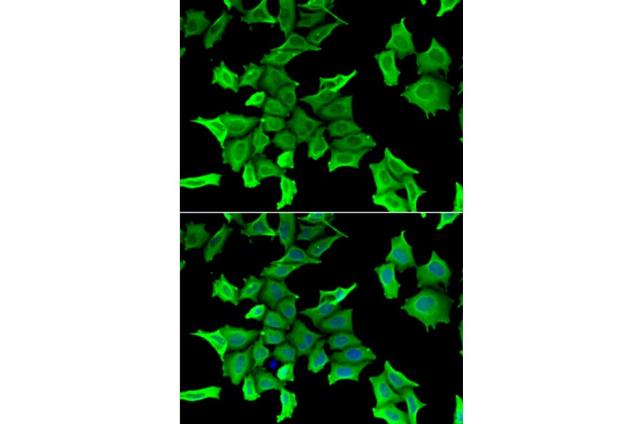 Immunofluorescence - SPINT2 antibody from Signalway Antibody (39150) - Antibodies.com