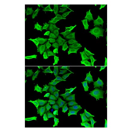 Immunofluorescence - SPINT2 antibody from Signalway Antibody (39150) - Antibodies.com
