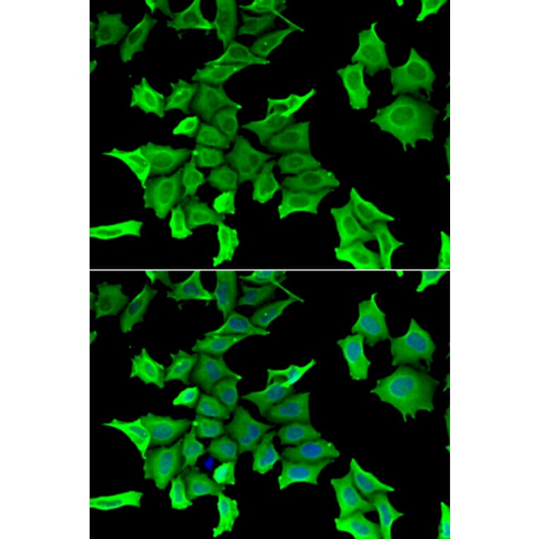 Immunofluorescence - SPINT2 antibody from Signalway Antibody (39150) - Antibodies.com
