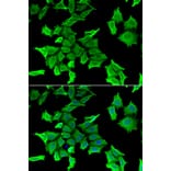 Immunofluorescence - SPINT2 antibody from Signalway Antibody (39150) - Antibodies.com