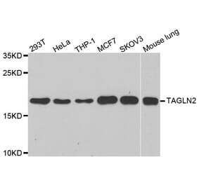 Western blot - TAGLN2 antibody from Signalway Antibody (39159) - Antibodies.com