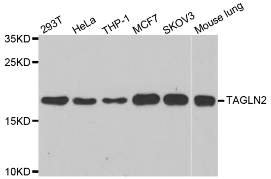 Western blot - TAGLN2 antibody from Signalway Antibody (39159) - Antibodies.com
