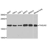 Western blot - TAGLN2 antibody from Signalway Antibody (39159) - Antibodies.com