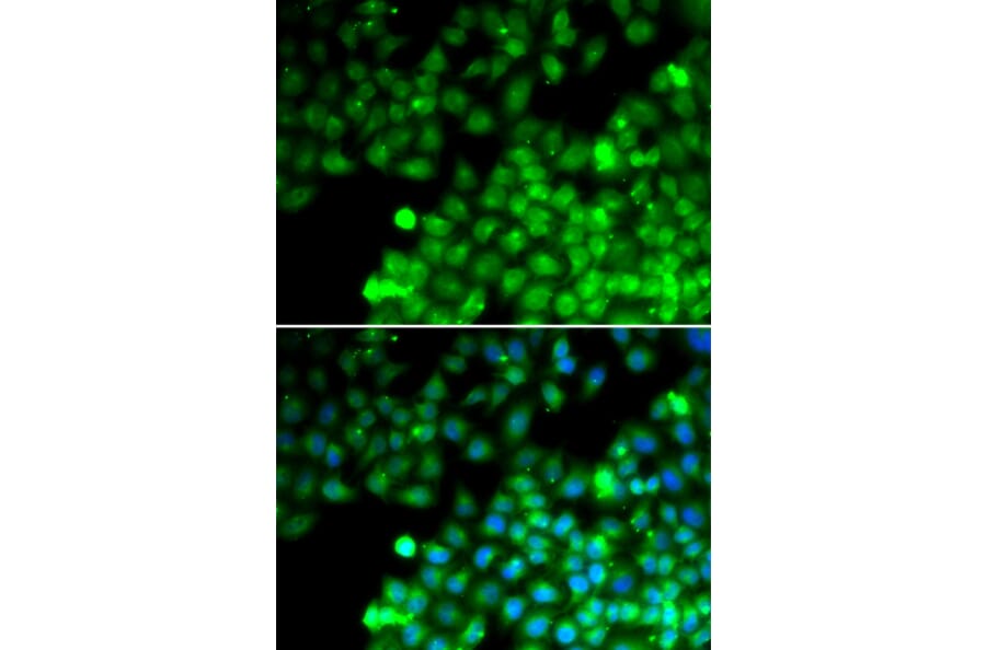 Immunofluorescence - TAGLN2 antibody from Signalway Antibody (39159) - Antibodies.com