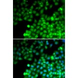 Immunofluorescence - TAGLN2 antibody from Signalway Antibody (39159) - Antibodies.com