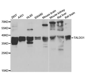 Western blot - TALDO1 antibody from Signalway Antibody (39160) - Antibodies.com
