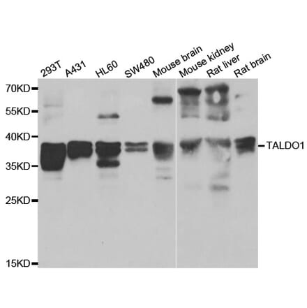 Western blot - TALDO1 antibody from Signalway Antibody (39160) - Antibodies.com