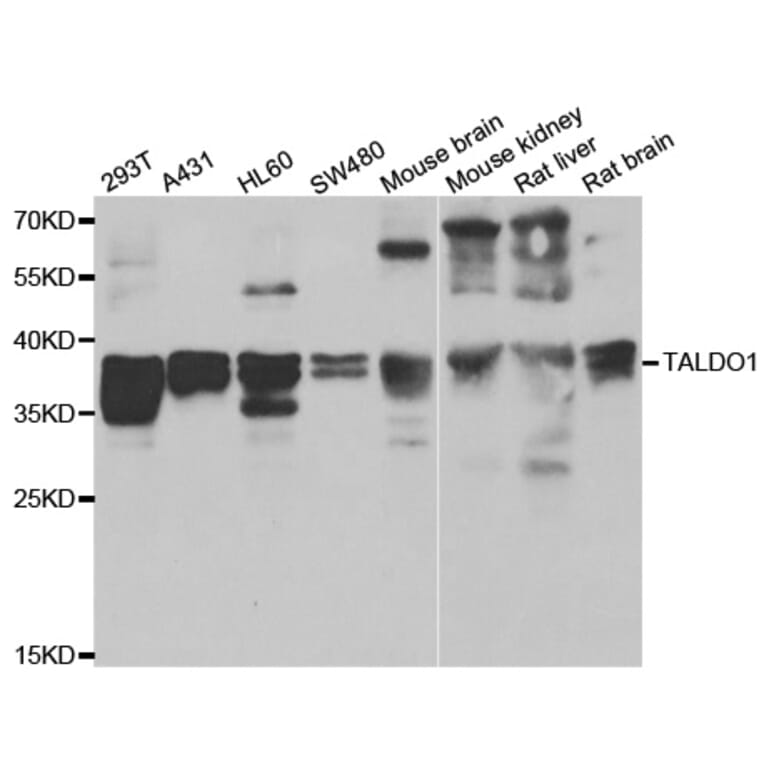 Western blot - TALDO1 antibody from Signalway Antibody (39160) - Antibodies.com