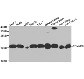 Western blot - TOMM20 antibody from Signalway Antibody (39170) - Antibodies.com
