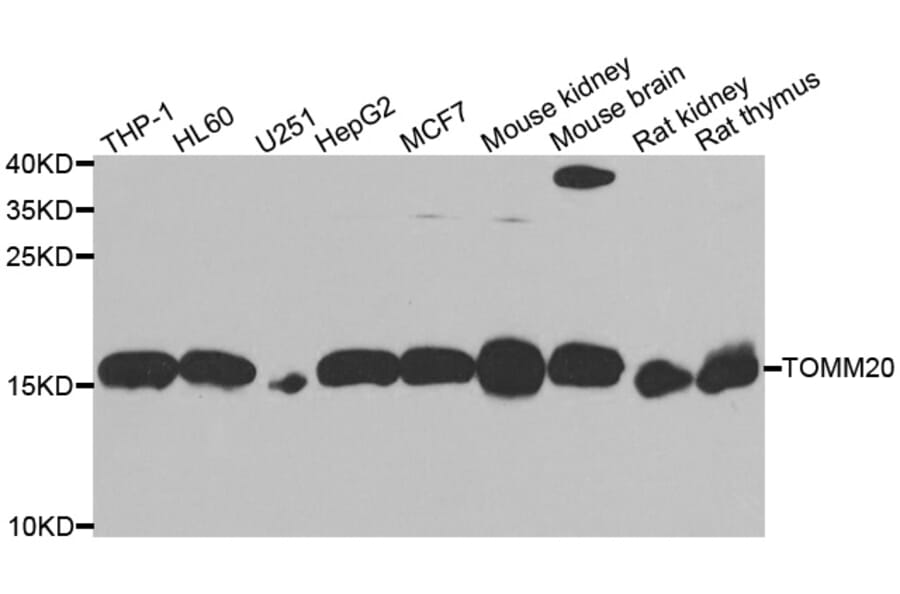 Western blot - TOMM20 antibody from Signalway Antibody (39170) - Antibodies.com