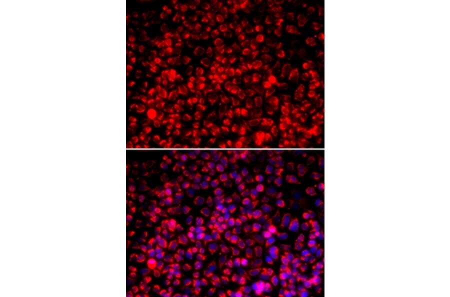 Immunofluorescence - TOMM20 antibody from Signalway Antibody (39170) - Antibodies.com