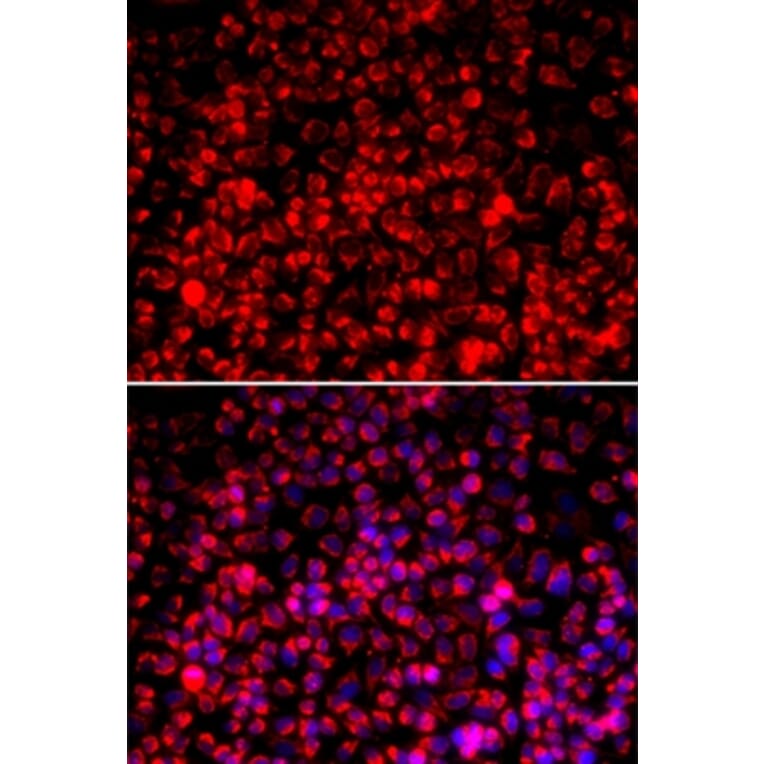 Immunofluorescence - TOMM20 antibody from Signalway Antibody (39170) - Antibodies.com