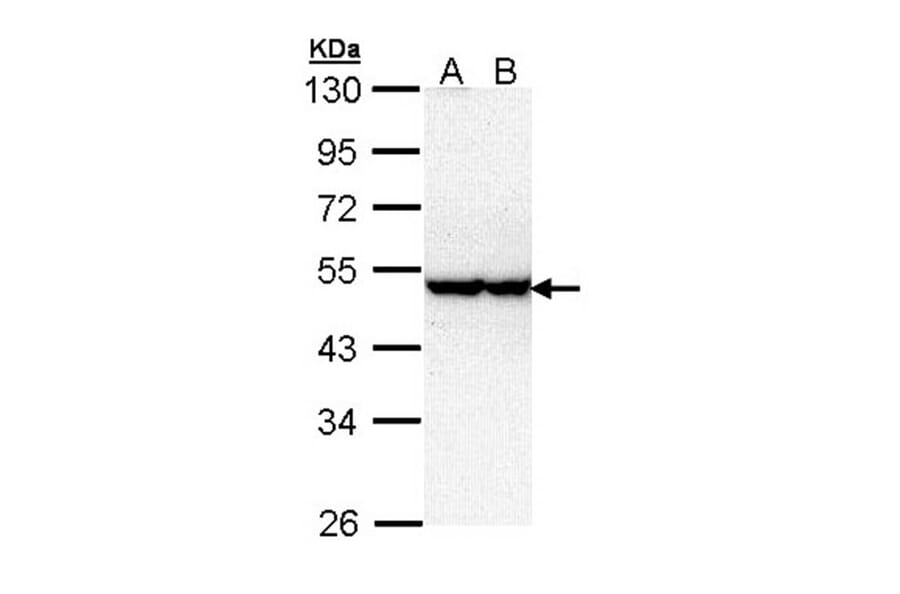 serine/threonine kinase 40 antibody from Signalway Antibody (22297) - Antibodies.com