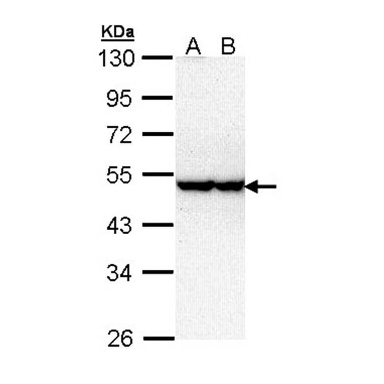 serine/threonine kinase 40 antibody from Signalway Antibody (22297) - Antibodies.com
