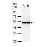 serine/threonine kinase 40 antibody from Signalway Antibody (22297) - Antibodies.com