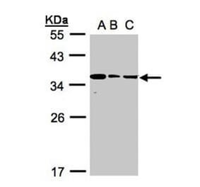 bisphosphoglycerate mutase antibody from Signalway Antibody (22970) - Antibodies.com